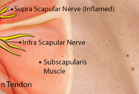 Celebrate your Failures